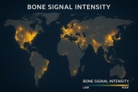 onyxbone_chapters/artefacts/bone_signal_global.jpg